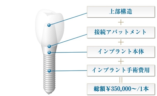 インプラントの構造